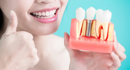 Aké sú chirurgické riziká pri umiestnení zubného implantátu?