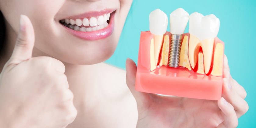 Aké sú chirurgické riziká pri umiestnení zubného implantátu?